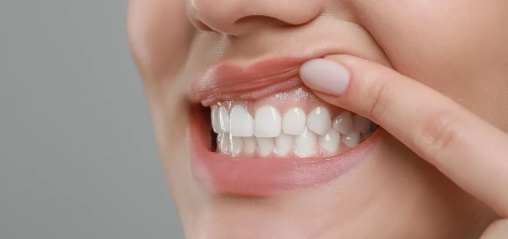 soins gencives Soins des gencives WP2 Template